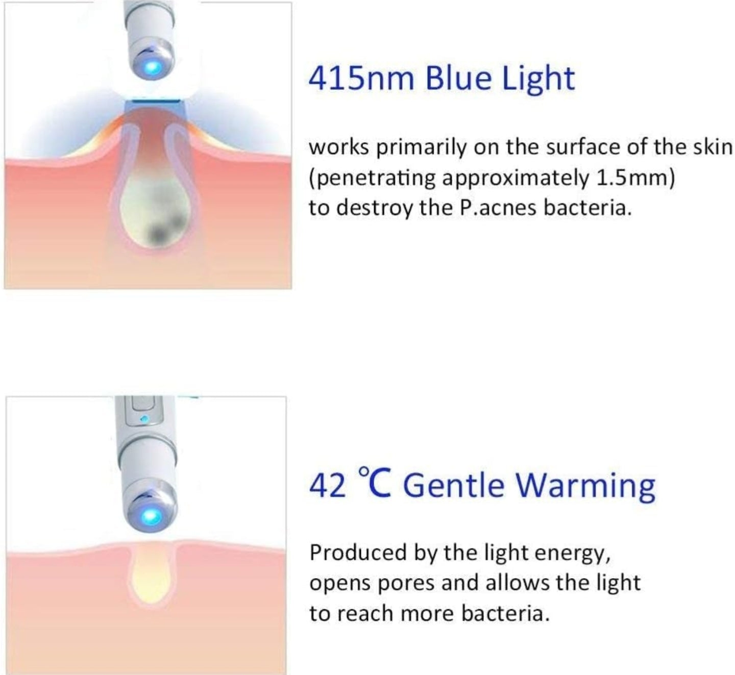 Blue Light Therapy Acne Laser Pen Soft Scar Wrinkle Removal Treatment Device Skin Care Beauty Equipment - No logo