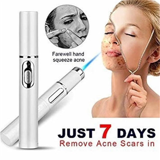 Blue Light Therapy Acne Laser Pen Soft Scar Wrinkle Removal Treatment Device Skin Care Beauty Equipment - No logo